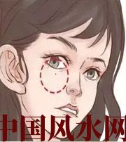 宿州脸上这些地方有痣，不利财运，一生难发大财